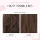 Moisturizing Anti-Dandruff Shampoo for Damaged Hair